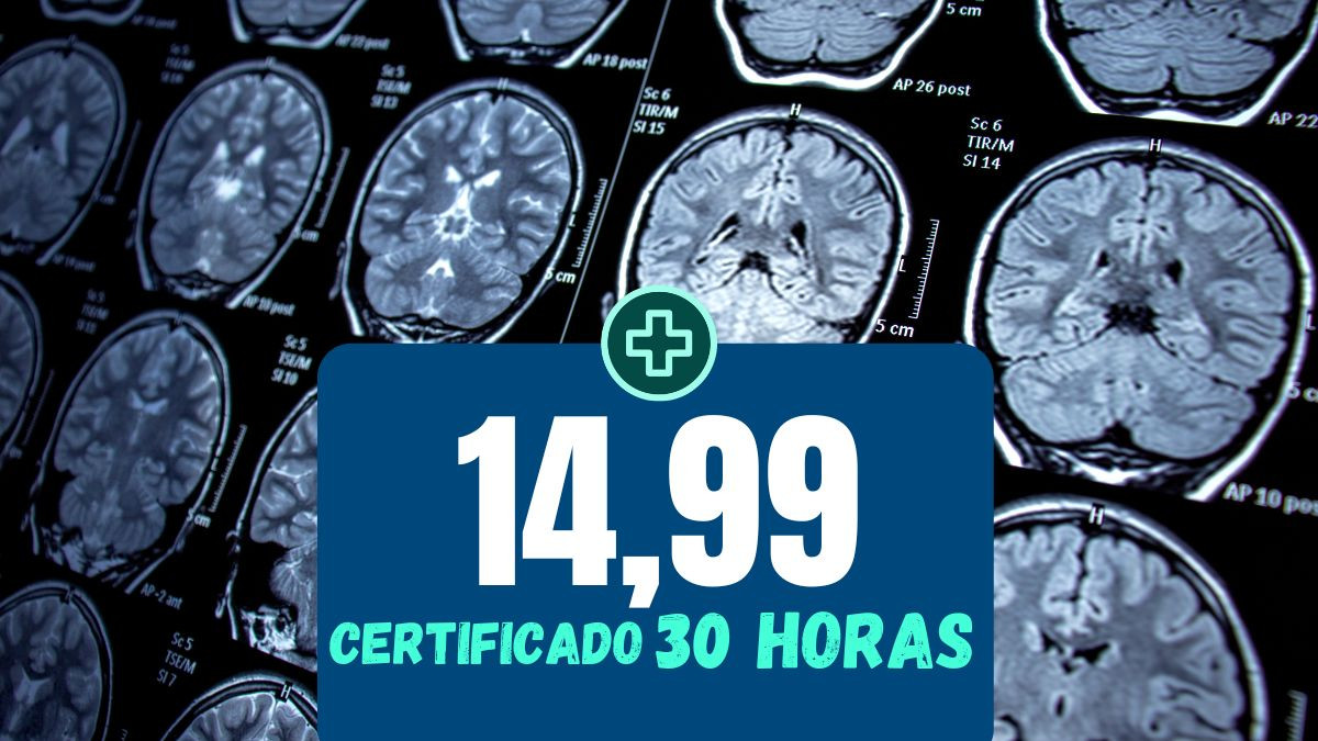 Sobre Assistência de Enfermagem em Doenças Neurológicas